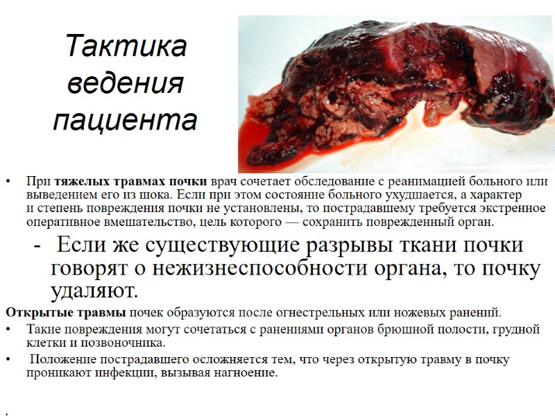 Тактика ведения пациента • При тяжелых травмах почки врач сочетает обследование с реанимацией больного